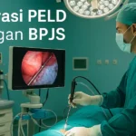 Operasi PELD dengan BPJS dan Prosedur