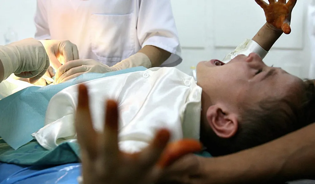 Prosedur Sunat Medis dengan BPJS Prosedur Sunat Medis dengan BPJS